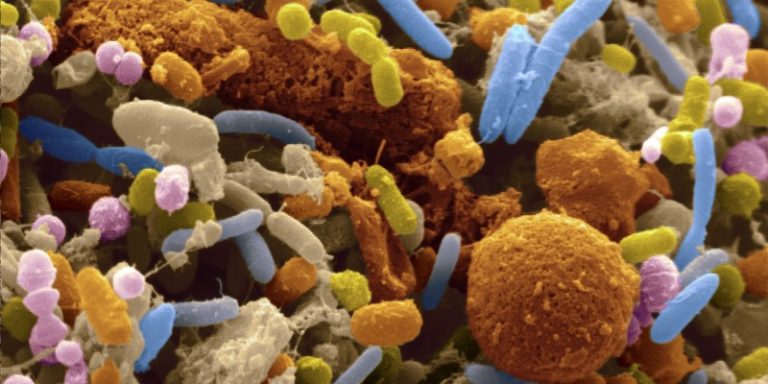 Gut Microbiota Gut Microbiota